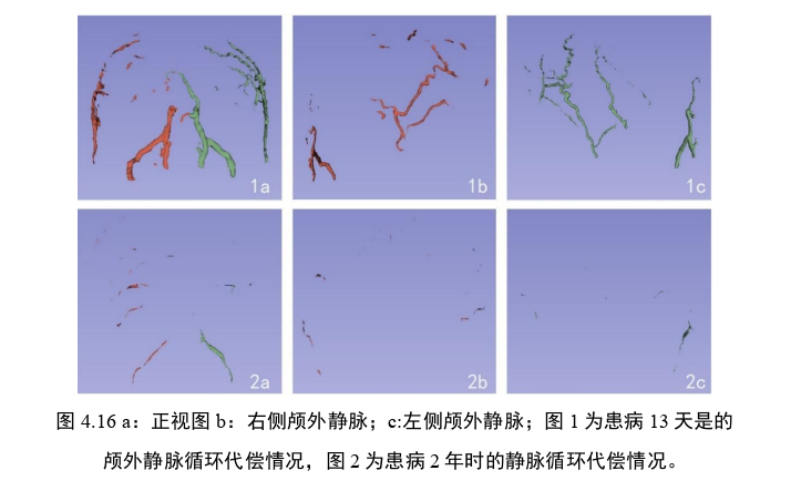 医学论文参考