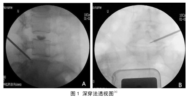 中医论文参考