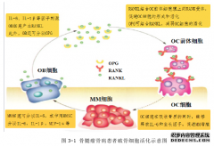 维生素D3、TRACP-5b及PINP在骨髓瘤骨病诊断及医学疗效评估中的意义