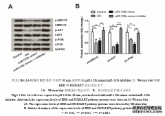 miR-133b在HCl诱导的人类食管鳞状细胞Het-1A医学损伤中的作用