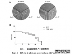 GPR109A对CLP小鼠肠道上皮屏障调控的医学作用机制