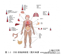 护理论文范文5篇